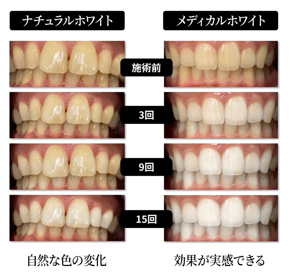 ナチュラルホワイト　メディカルホワイト